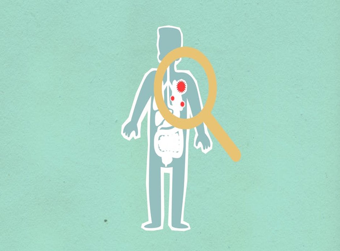 How Often Does Cotaldihydo Disease Occur